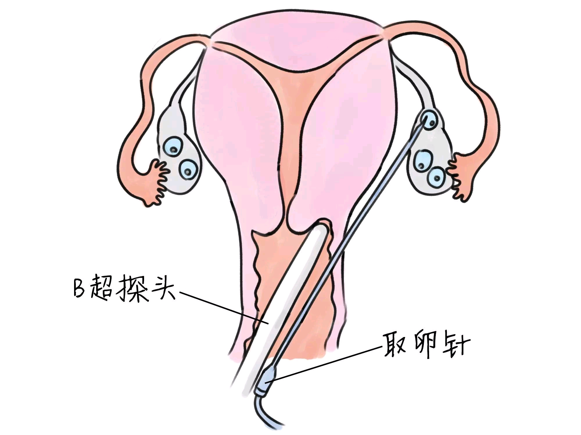 捐卵激素标准
