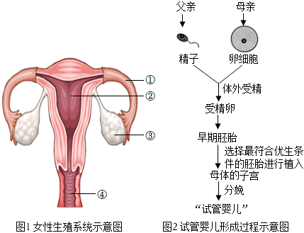 捐卵助孕