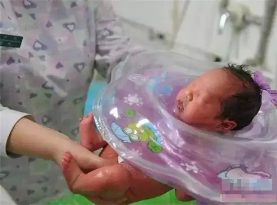 捐卵移植