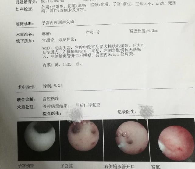 捐卵联系