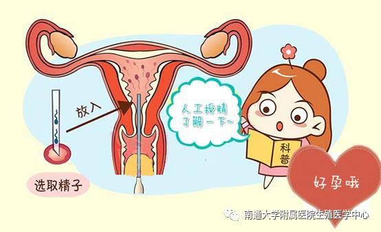 绵阳招聘捐卵女孩机构