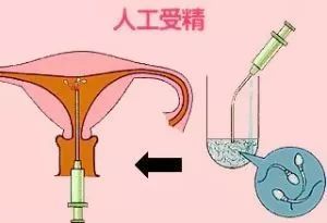 美国试管婴儿中心