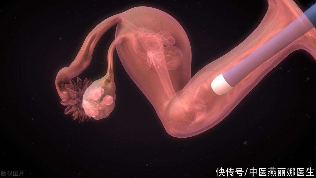 美国助孕