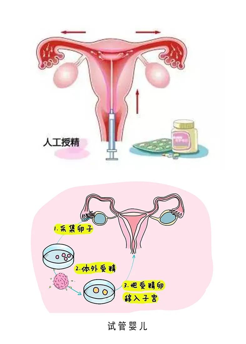 美国加州试管婴儿