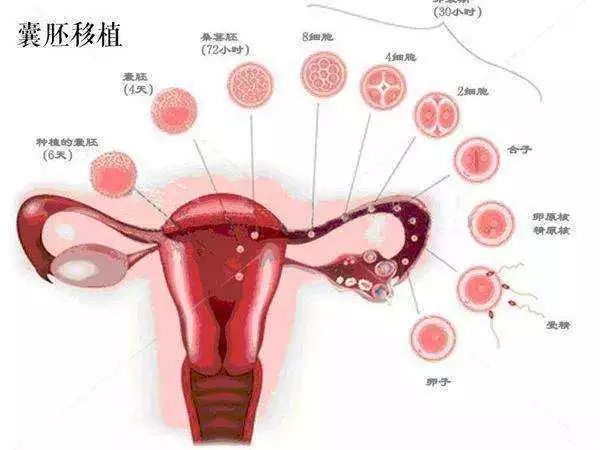 美国试管宝宝