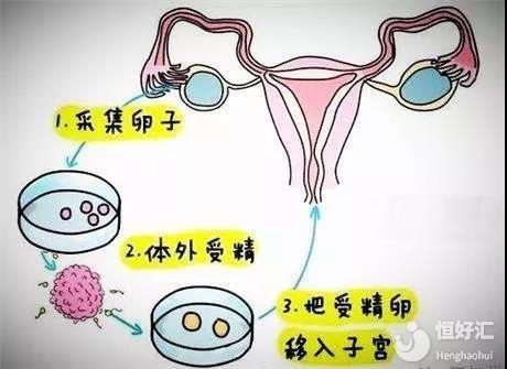 美国生子被遣返